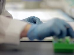 ECU PAN Lab techinican making notes from sample at Healthcare medicine Industry DNA sequencing Laboratory / Vancouver, BC, Canada    Stock Footage