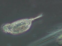 Rotifer next to algal filament Stock Footage
