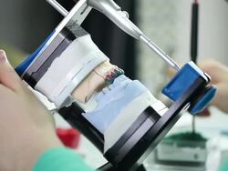 Dental prosthesis Stock Footage