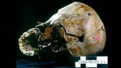 Fredy Peccerelli: A forensic anthropologist who brings closure for the "disappeared" Instructional Video