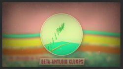 TED-Ed: What is Alzheimer's disease? - Ivan Seah Yu Jun Instructional Video