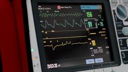 Defibrillator Stock Footage