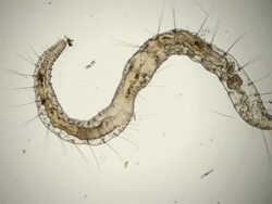 annelid worm, Pristina species, micrograph Stock Footage