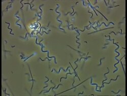 Spirochaeta bacteria and other bacteria moving in pond water. Phase Contrast; good motility Stock Footage