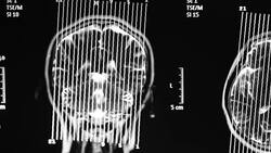 X-Ray Film Stock Footage