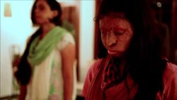 CLEAN : Indian acid attack vicims take a yoga class News Clip