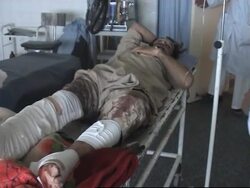 At least 21 civilians killed by air strike, wounded in hospital News Clip