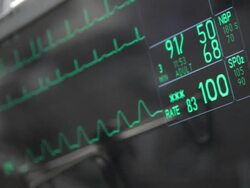 Heart Beat Monitor Screen, Pulse Trace, Medical Exam Stock Footage