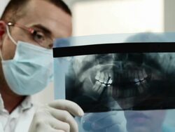 Dental x-ray Stock Footage