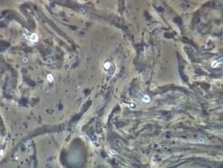 Human sperm swept along in ejaculate Stock Footage