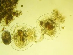 rotifers Stock Footage