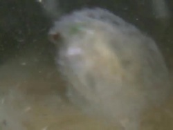 Daphnia with epibiotic growth. Epibiotic Ciliates growing on the surface of living Daphnia. Sample collected from Dolbryn pond and imaged using a 3mm Endoscope and Sony PMW-EX3 Full HD video camera. Horizontal field of view approximately 4mm. Stock Footage