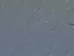Bacteria from a stagnant pond, incl Vibrio. Stock Footage
