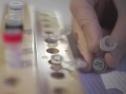 CU, R/F, Person transferring material from one test tube to another, close-up of hand Stock Footage