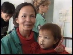 VIETNAM: AMERICAN PLASTIC SURGEONS REPAIR SMILES News Clip