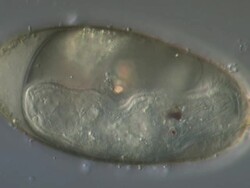 Egg of the Liver Fluke Fasciola hepatica showing ciliated miracidium, recorded using Differential Interference Contrast. Egg length is 140 microns. Stock Footage