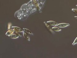 ECU T/L Shot of amoeba crawling on surface of microscope slide searching for prey Stock Footage