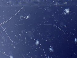 Micro organisms Stock Footage