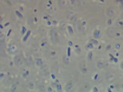 Bacteria: Escherischia coli K12 strain, Phase contrast Stock Footage