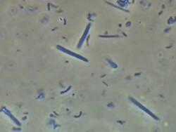 Human tongue bacteria from Human tongue scrape. Recorded using Phase Contrast illumination, horizontal field of view 100 micrometres. Stock Footage