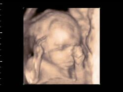 Foetus moving arms, 4D ultrasound.. Stock Footage