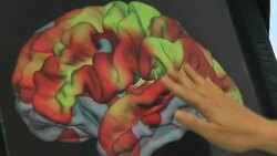 "Super agers" with the brains of 50 year olds might hold key to dementia News Clip