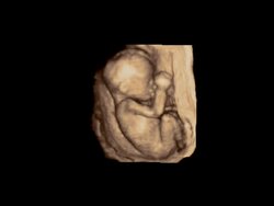 Foetus in the womb from side on, rotating ultrasound.. Stock Footage
