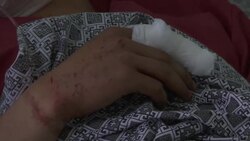 Wounded in hospital after Kabul suicide attack Instructional Video