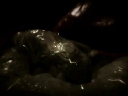 Extreme Close Up push-in push-out - A mosquito penetrates skin with its proboscis in a computer-generated animation. Stock Footage