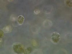 Dinoflagellates (Peridinium sp.) moving rapidly Stock Footage