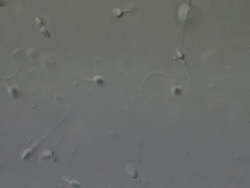 Human sperm swimming, Interference contrast Stock Footage