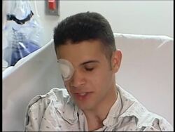 Palestinian boy injured in clashes receives facial surgery News Clip