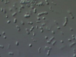 Friendly bacteria, Lactobacillus casei. A rod-shaped gram-positive, non-sporing, non-motile, obligate anaerobe, which inhabits human intestinal tracts. It is beneficial to human health eg improves and promotes digestion. Stock Footage