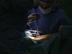 MS Surgery assistant helping surgeon / Cagliari, Sardinia, Italy Stock Footage