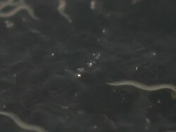 T/L Macro shot of Caenorhabditis elegans feeding on lawn of bacteria (Escherischia coli OP50) Stock Footage