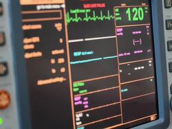 Vital Signs Monitor Stock Footage