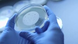 Scientist examining sample on Petri dish Stock Footage