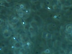 Human sperm, lots swimming, turquoise background Stock Footage