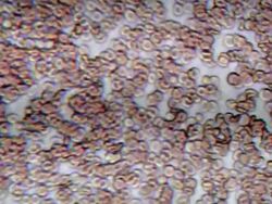 Blood cells under microscope Stock Footage