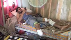 CLEAN : Yemen: Difficult medical treatment for progovernment fighters News Clip