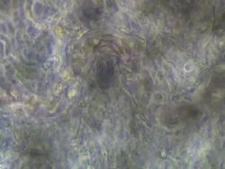 Phase Contrast view of Toad (Bufo bufo) tadpole tail capillary with Leucocte rolling. Olympus BH-2 microscope, Olympus S-Plan 10x phase objective, NFK 5x photoeyepiece. Stock Footage