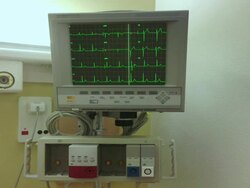ECG  monitor with sound Stock Footage