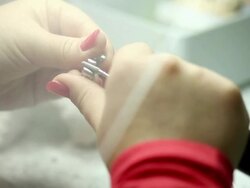 Manufacturing of dental prosthesis Stock Footage