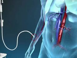 New Cancer Drug Improves Chances of Survival News Clip