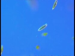 Microscopic shot of Euglena swimming Stock Footage