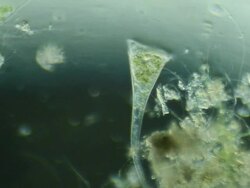 Microorganism - Stentor Stock Footage