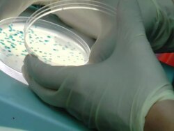 Blue bacteriophage plaques Stock Footage