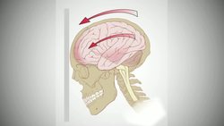 Jane McGonigal: The game that can give you 10 extra years of life Instructional Video