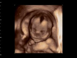 Foetus raising hands above head, 4D ultrasound.. Stock Footage