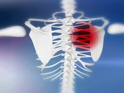 HD: Human Skeleton Indicates A Shoulder Pain Stock Footage
